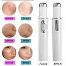 Blue Light Therapy Acne/Wrinkle Laser Pen